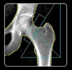 Sample hip scan