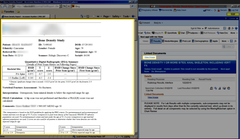epic with bd report - annotated - blog